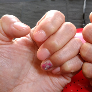 ネイルギャラリー15